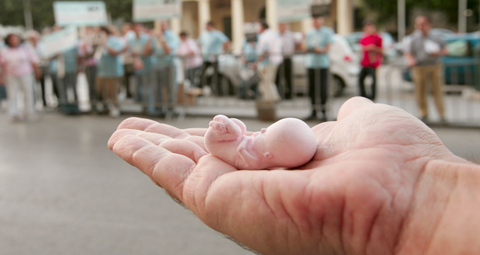 10-FOETUS 10-FOETUS